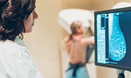 Assessing risk of breast cancer in young women to facilitate early diagnosis and improve outcomes